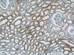 NDUFV3 Antibody in Immunohistochemistry (Paraffin) (IHC (P))