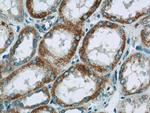 NDUFV3 Antibody in Immunohistochemistry (Paraffin) (IHC (P))