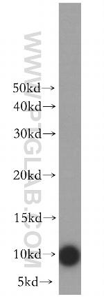 NDUFV3 Antibody in Western Blot (WB)