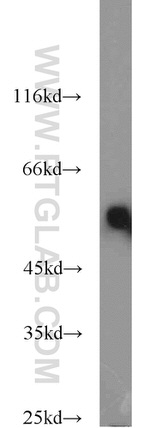 CYP51A1 Antibody in Western Blot (WB)