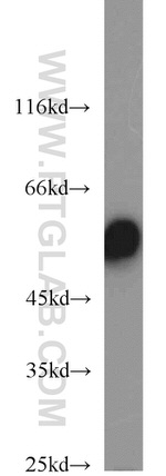 CYP51A1 Antibody in Western Blot (WB)