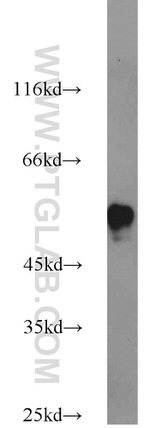 CYP51A1 Antibody in Western Blot (WB)