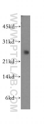 CSRP1 Antibody in Western Blot (WB)
