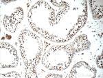 ALS2CR8 Antibody in Immunohistochemistry (Paraffin) (IHC (P))