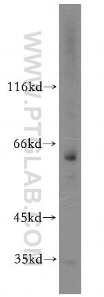 Twinkle Antibody in Western Blot (WB)