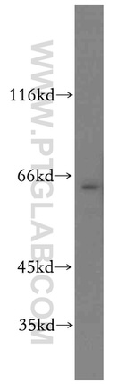 Twinkle Antibody in Western Blot (WB)