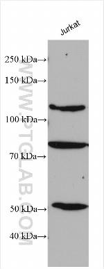 MTUS1 Antibody in Western Blot (WB)