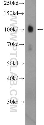 EPB41L1 Antibody in Western Blot (WB)