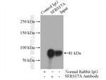 SFRS17A Antibody in Immunoprecipitation (IP)