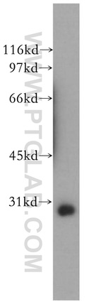 GIMAP2 Antibody in Western Blot (WB)
