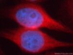 MAP7 Antibody in Immunocytochemistry (ICC/IF)