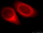 MAP7 Antibody in Immunocytochemistry (ICC/IF)