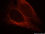MAP7 Antibody in Immunocytochemistry (ICC/IF)