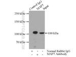 MAP7 Antibody in Immunoprecipitation (IP)