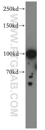 MAP7 Antibody in Western Blot (WB)