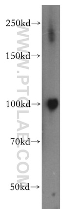 MAP7 Antibody in Western Blot (WB)