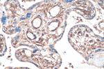 PDGFRB Antibody in Immunohistochemistry (Paraffin) (IHC (P))