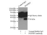 PSTPIP2 Antibody in Immunoprecipitation (IP)