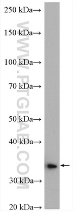 GPD1 Antibody in Western Blot (WB)