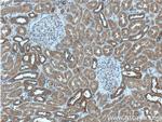 MAPK15 Antibody in Immunohistochemistry (Paraffin) (IHC (P))