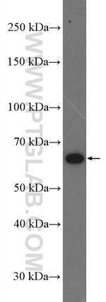 MEI1 Antibody in Western Blot (WB)