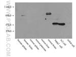 CETP Antibody in Western Blot (WB)