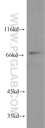 CETP Antibody in Western Blot (WB)