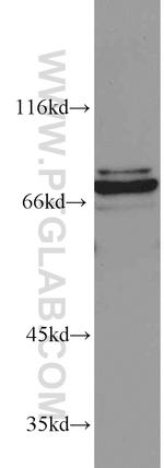 CETP Antibody in Western Blot (WB)