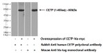 CETP Antibody in Western Blot (WB)