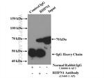 RHPN1 Antibody in Immunoprecipitation (IP)