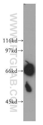 RHPN1 Antibody in Western Blot (WB)