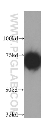 RHPN1 Antibody in Western Blot (WB)