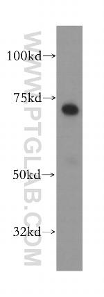 RHPN1 Antibody in Western Blot (WB)