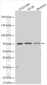 CABLES1 Antibody in Western Blot (WB)