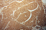 HIBADH Antibody in Immunohistochemistry (Paraffin) (IHC (P))