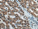 HIBADH Antibody in Immunohistochemistry (Paraffin) (IHC (P))