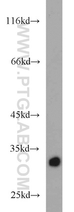 HIBADH Antibody in Western Blot (WB)