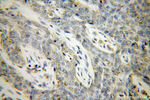 VASP Antibody in Immunohistochemistry (Paraffin) (IHC (P))