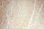 VASP Antibody in Immunohistochemistry (Paraffin) (IHC (P))