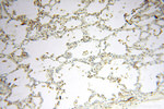 VASP Antibody in Immunohistochemistry (Paraffin) (IHC (P))