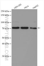 SYVN1 Antibody in Western Blot (WB)
