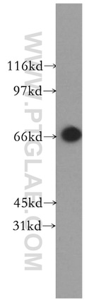SYVN1 Antibody in Western Blot (WB)