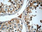 Cryptochrome 1 Antibody in Immunohistochemistry (Paraffin) (IHC (P))