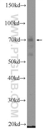 Cryptochrome 1 Antibody in Western Blot (WB)