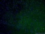 TREM2 Antibody in Immunohistochemistry (PFA fixed) (IHC (PFA))