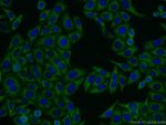MTMR4 Antibody in Immunocytochemistry (ICC/IF)