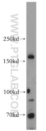 MTMR4 Antibody in Western Blot (WB)