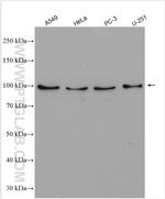 NLGN4Y Antibody in Western Blot (WB)