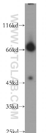 NLGN4Y Antibody in Western Blot (WB)