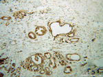B3GALT4 Antibody in Immunohistochemistry (Paraffin) (IHC (P))